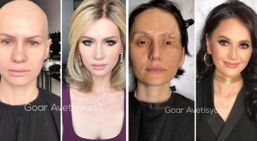 Ces femmes au visage marqué prouvent qu'on a toutes notre place sur le tapis rouge